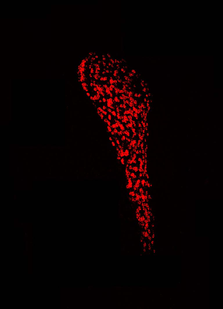 red-marked cells in the thalamus