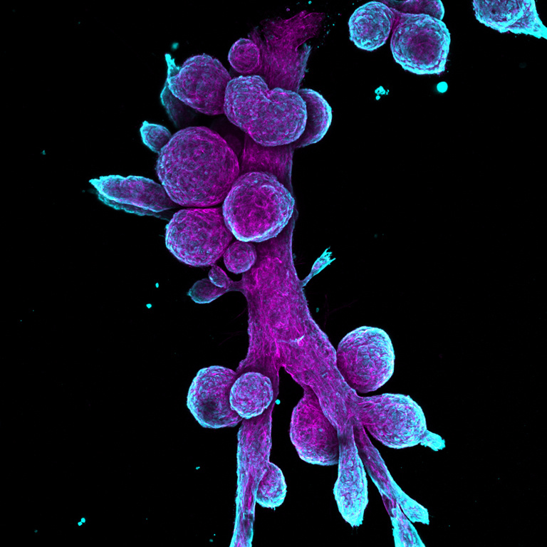 mammary gland organoids