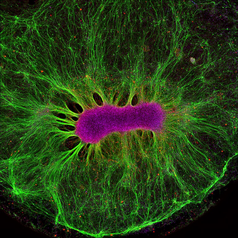 pink oblong cell cluster and long green cells extending radially