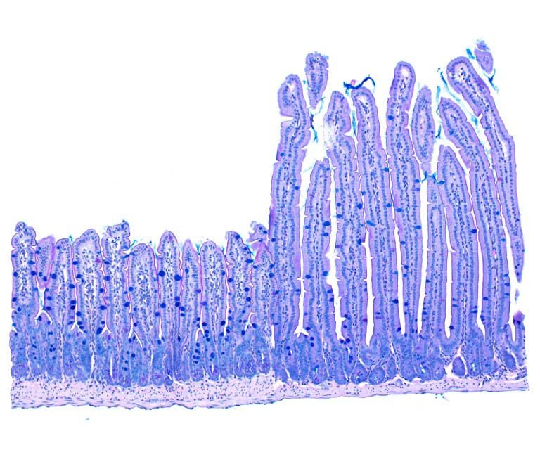 side-by-side comparison of two histology specimens