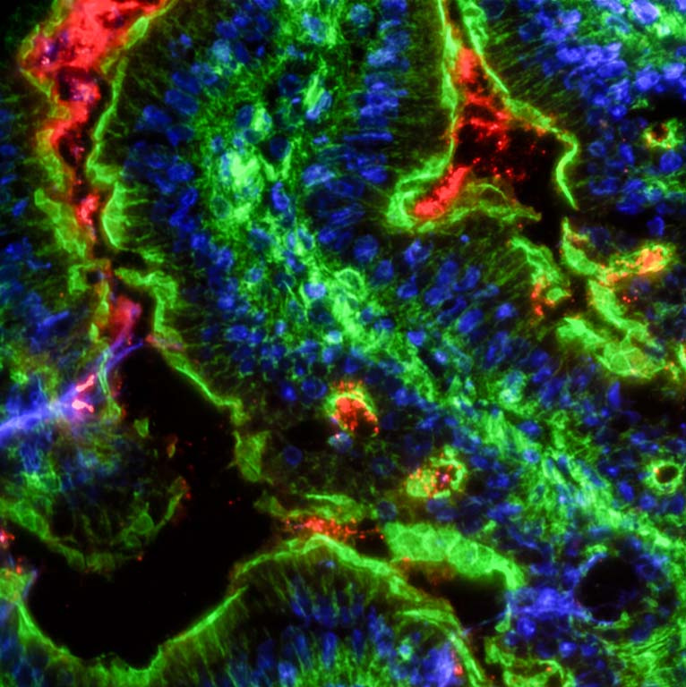 view of the large intestine using fluorescence microscopy