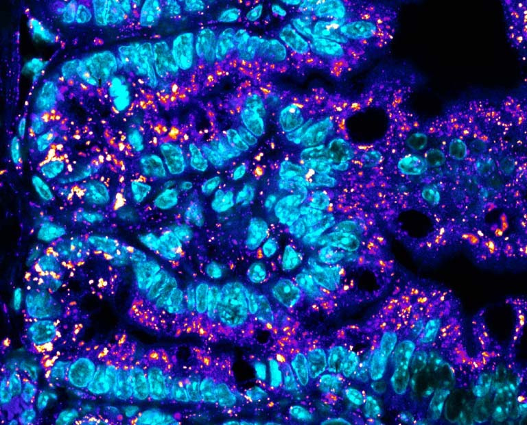 curved strands of intestinal cells