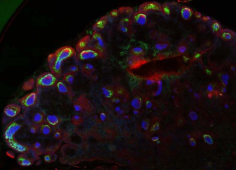 fluorescent cells in a lymph node