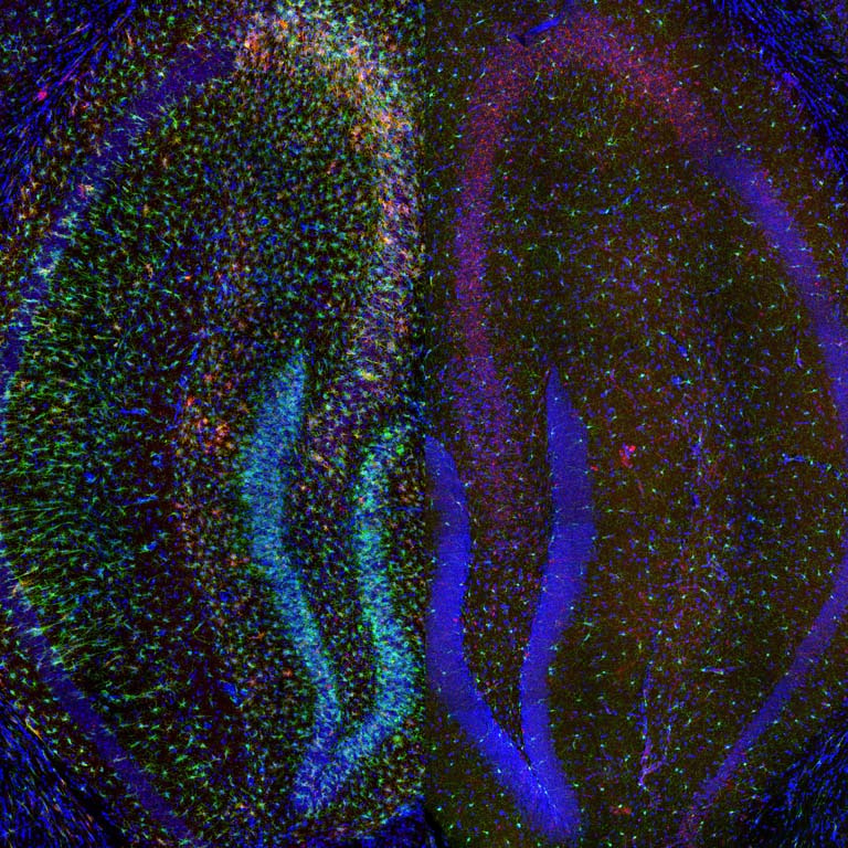 side by side comparison of brain structures with fluorescent tags