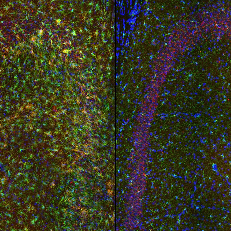 side by side comparison of stained cells