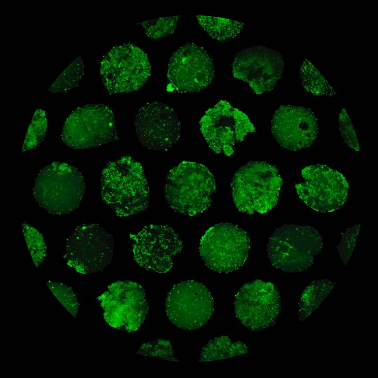 green clusters of bacteria