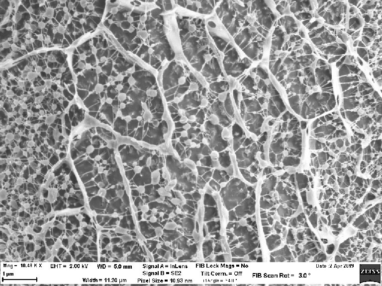 cryo-E-M view of a hydrogel mesh