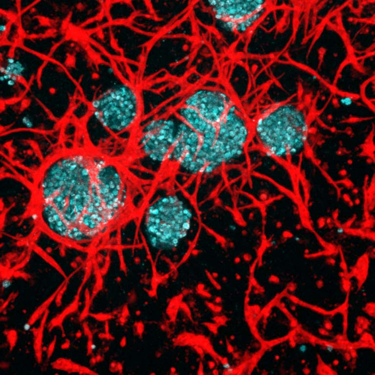 red vessels surround blue cells