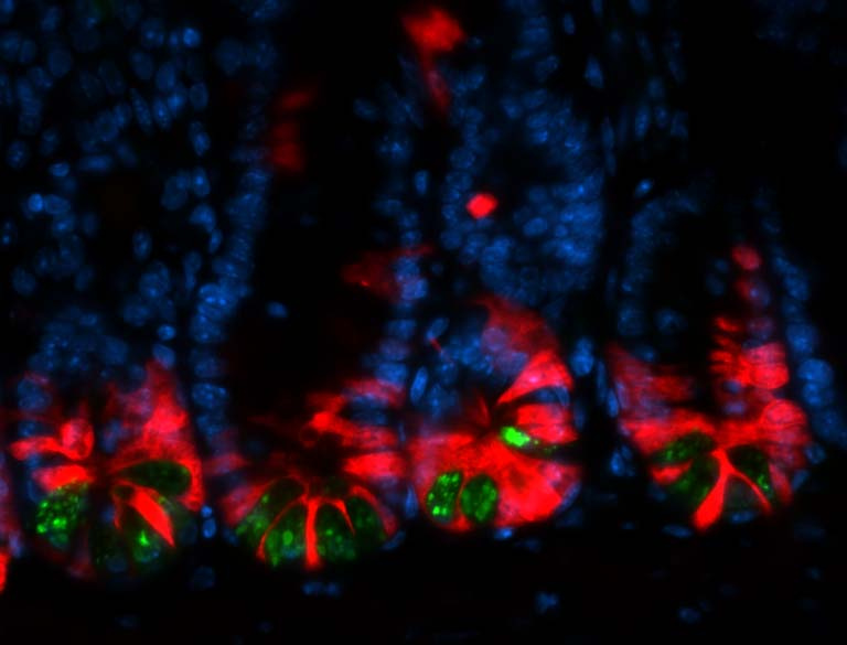 intestinal cells marked in red, blue, and green