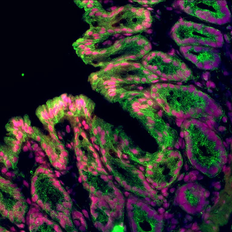 fluorescently stained cells in the colon