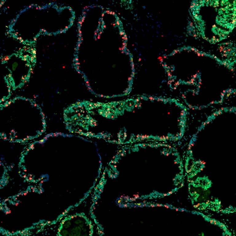 lacy green loops of cells outline empty black space