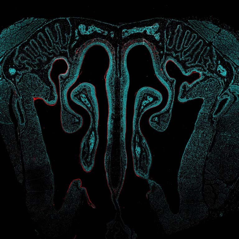 wide view of curved nasal passages with red dots throughout