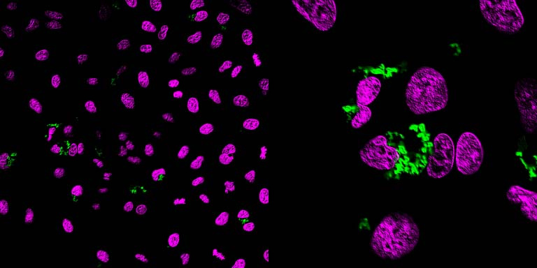 two panels of purple cells with green dots, close-up view on the right