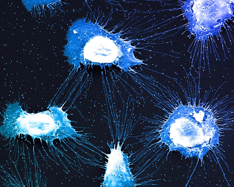 five sprawling cells with white nuclei and blue cytoplasm are connected by thin blue filaments against a black background