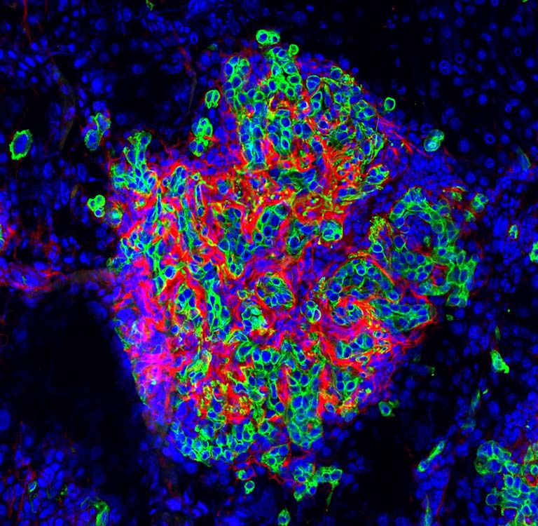 a stylized trapezoidal cluster of interspersed cells in red, blue, and green