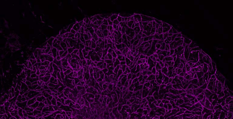 a half-circle of mesh-like magenta cells against a black background