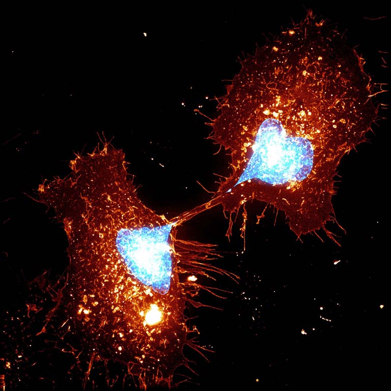 orange material stretches between and around two dividing cells with bright nuclei 