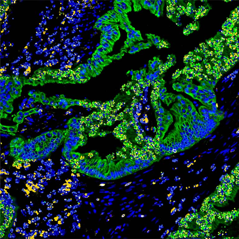 nine-tile mosaic of blue and green cells and proteins