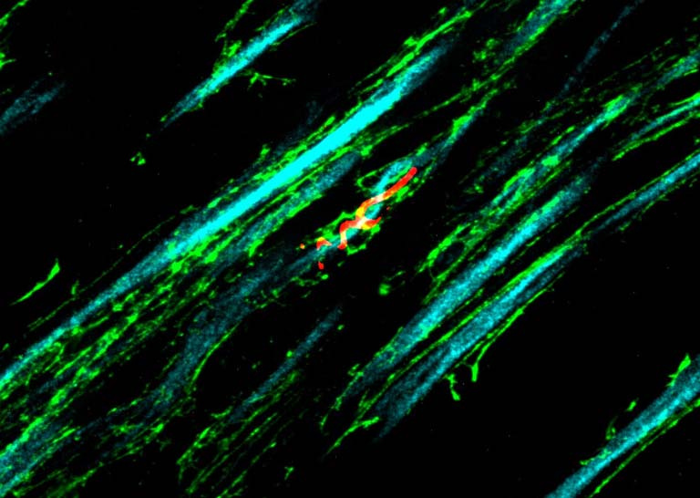 a protein spirals around a long thin bundle of axons—one of many in a field of neurons