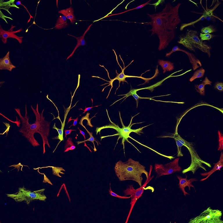 A plethora of spidery cells in reds, greens, oranges, and yellows against a black background