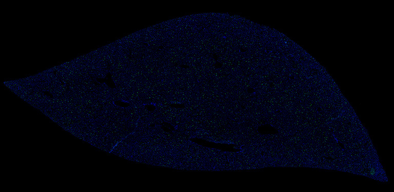 Liver structure with blue dots in a black background