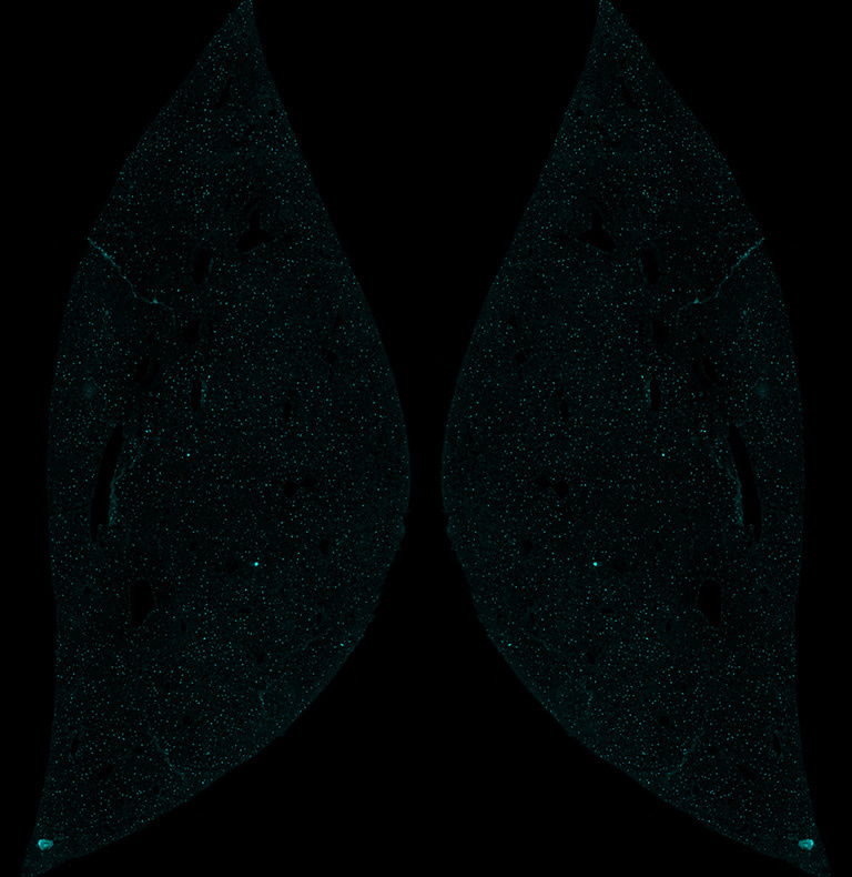 Liver structure with bright cyan dots in a black background