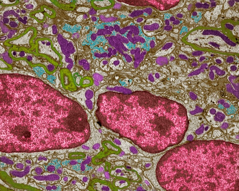 Complex purple, green, cyan and large pink cell structures