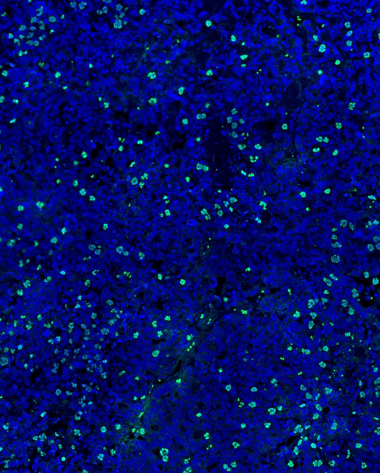 Dense blue structures with green fluorescent spots in a black background