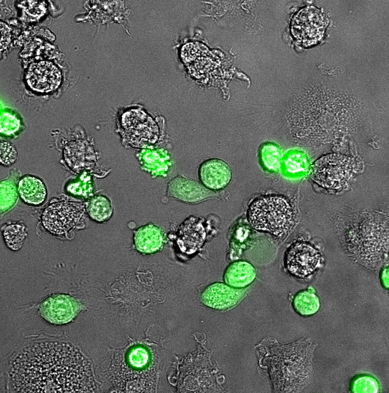 Green and grey cell like structures in a grey background