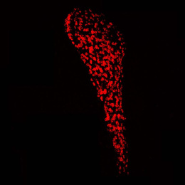 red-marked cells in the thalamus