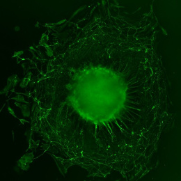 A green spherical neuron body surrounded by a web of green