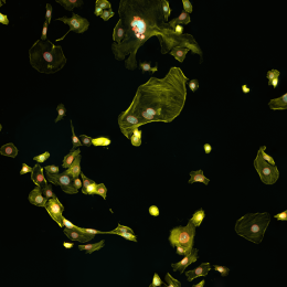 Green leaflike  structures glowing and floating in black.