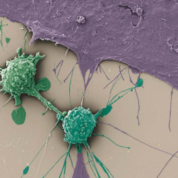 round green immune cells attack flat purple cells