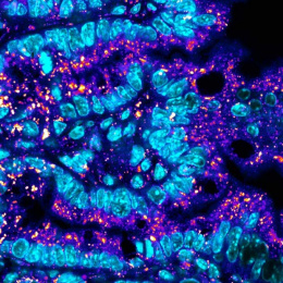 curved strands of intestinal cells