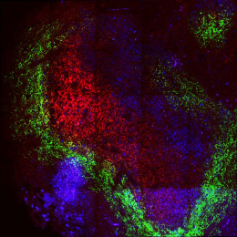 fluorescent cells in a lymph node