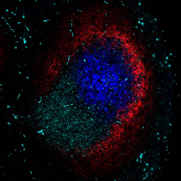 fluorescent cells in a lymph node