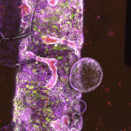 column of engineered cells