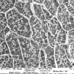 cryo-E-M view of a hydrogel mesh