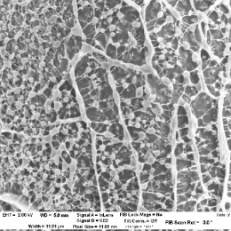 cryo-E-M view of a hydrogel mesh