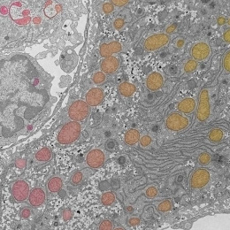 collection of cells in grayscale with false color highlights in shades of pink, orange, and yellow