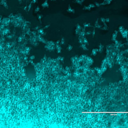 intestinal cells in cyan