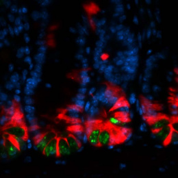 intestinal cells marked in red, blue, and green