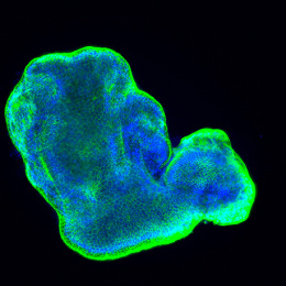 blue- and green-stained cells form a lumpy-looking 3D structure