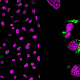 two panels of purple cells with green dots, close-up view on the right