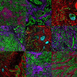 nine-panel mosaic of histological samples