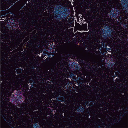 stained cells cluster within lung tissue