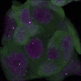 fuzzy purple cell structures with fuzzy green material surrounding and glowing spots within them