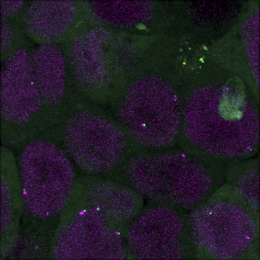 fuzzy purple cell structures with fuzzy green material surrounding and glowing spots within them