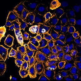 golden ringed nuclei, colored blue, cluster in a mass. The gold is more prominent in the cells on the left.