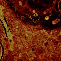 Cells colored red and yellow fill a horizontal field. Yellow stripes outlined with green cut across the lefthand side while swirls of black and red dominate the top